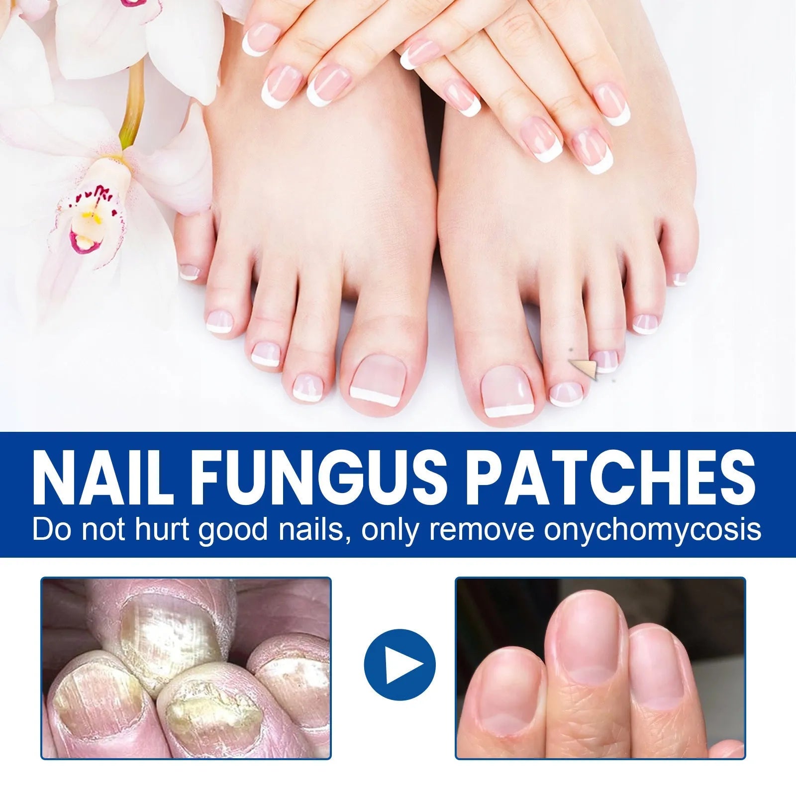 Box of 32 nail nursing adhesive bandage patches with garlic extract and tea tree oil for nail repair