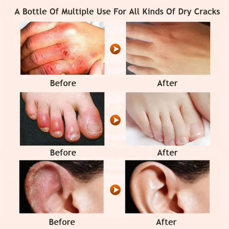Honey moisturising cream foot cream leg cream 20g with honey and avocado extracts