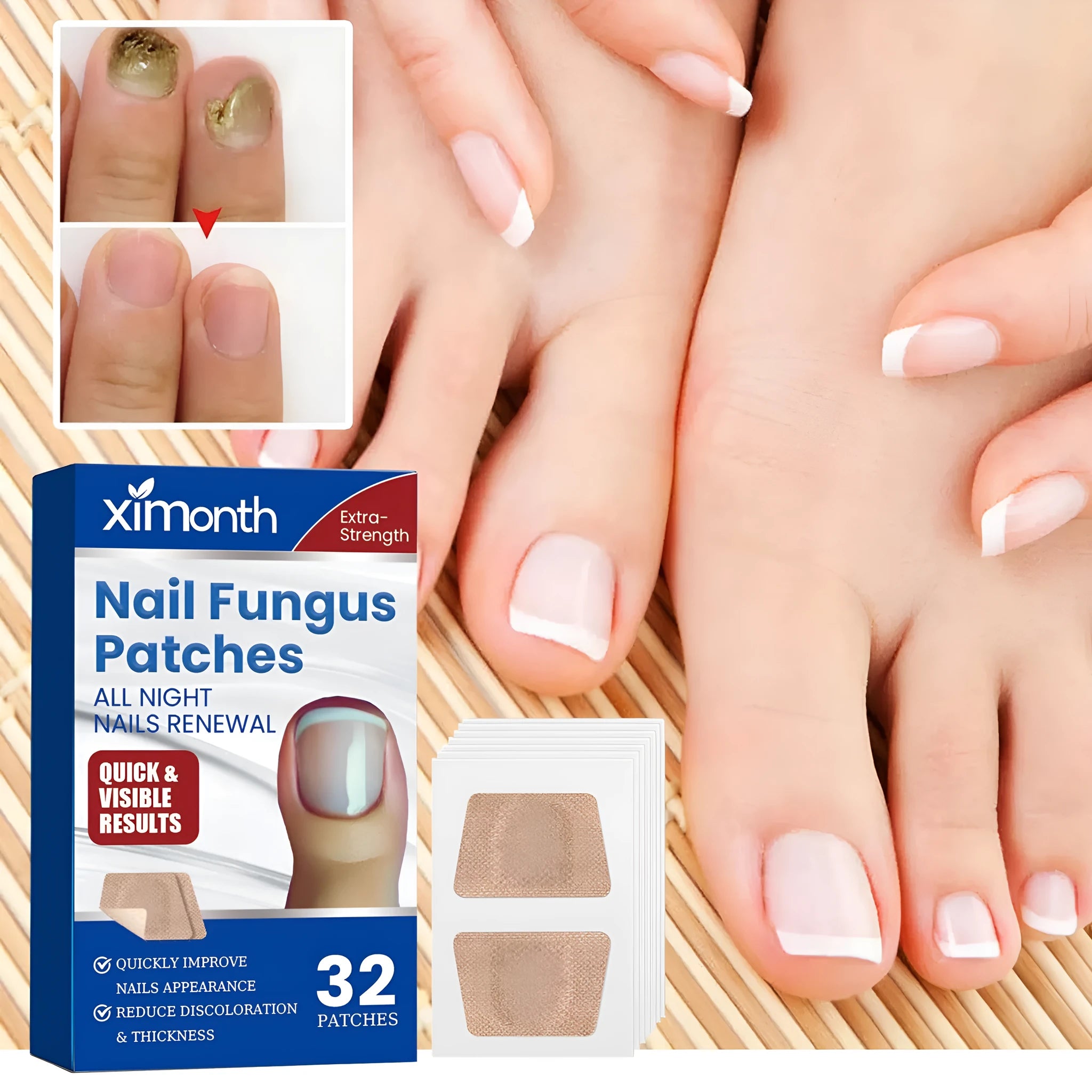 Box of 32 nail nursing adhesive bandage patches with garlic extract and tea tree oil for nail repair
