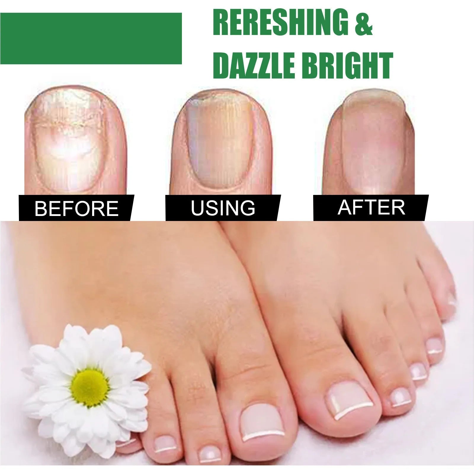 30ml bottle of tea tree oil nail repair liquid with dropper for thickened brittle nails