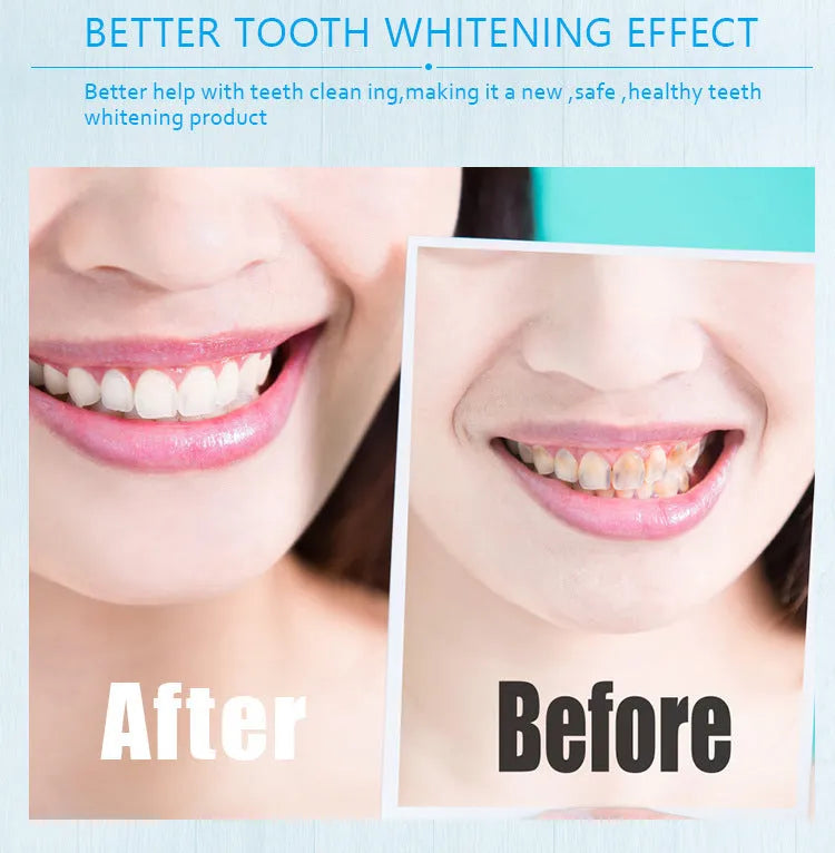 Toothbrush whitening pen in a choice of plastic or aluminium case colours with gel inside.