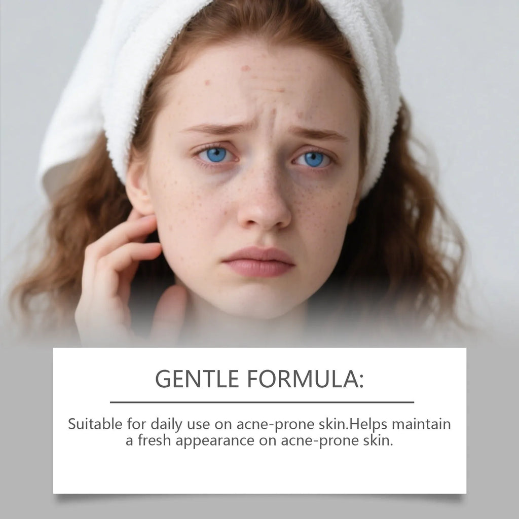 80-count pack of gentle hydrocolloid facial acne patches for spot treatment