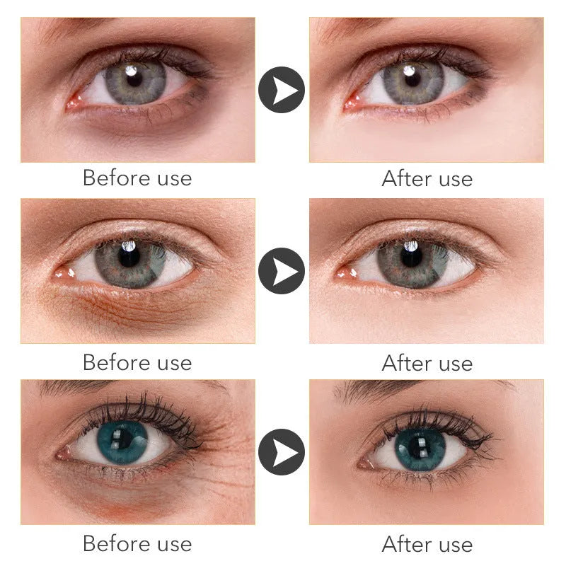 30ml pump bottle of Beauty Eye Cream for women's under-eye skincare